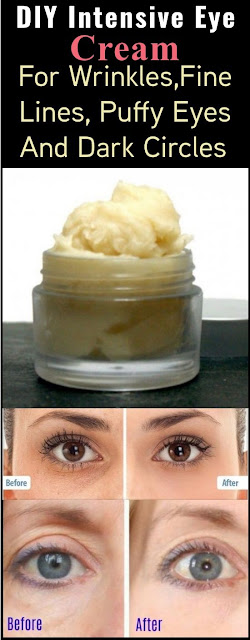 Homemade Intensive Eye Cream For Wrinkles,Fine Lines, Puffy Eyes And Dark Circles