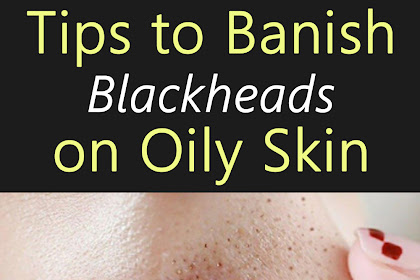 Tips to Banish Blackheads on Oily Skin