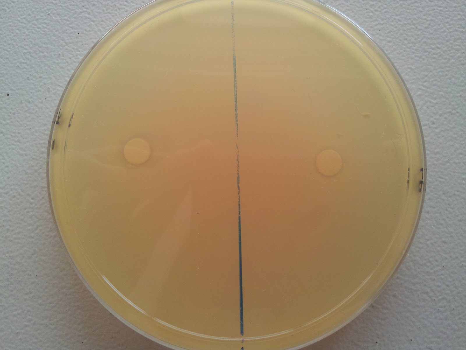 IBG Lab Report LAB 5 DETERMINATION OF ANTIMICROBIAL EFFECTS ON