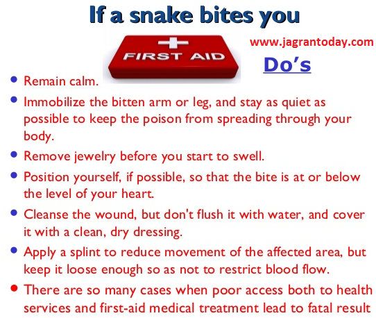 Tips to Treat Snake Bite