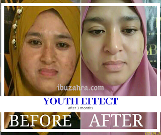 facial, servis, kuantan, pahang, pantai timur, youth, shaklee, spa shaklee, twb, the walking beauty