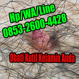 Pilihan Jenis Obat Kutil Kelamin Kimia