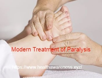 Modern Treatment of Paralysis