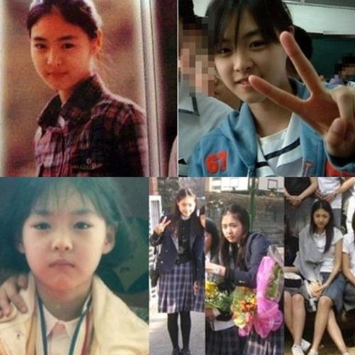 Lee Yeon Hee Melakukan Operasi Plastik