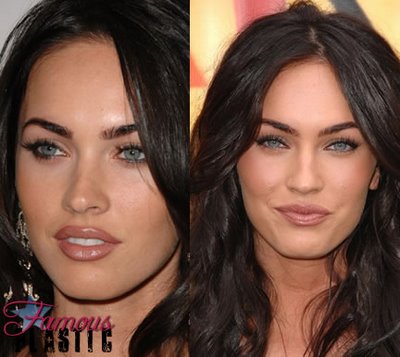 megan fox before and after plastic surgery pictures. Megan Fox Plastic Surgery