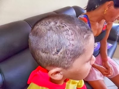 TIANGUÁ-CE: Criança de 10 anos sobrevive após ser baleada na cabeça em assalto