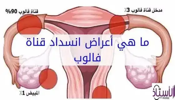 What-are-the-symptoms-that-indicate-blockage-of-the-fallopian-tubes