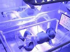 phototherapy for neonatal jaundice adverse effects