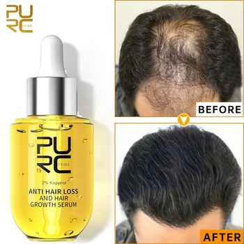 #HairGrowthOil #HairOil #MenHairOil #WomenHairOil #GingerOil #HairLossOil # HairTreatmentOil #HairEssentialsOil #HairSerumOil #HairBeautyoil #Hairhealthoil #newhairoil #besthairoil #brandhairoil, AliexpressForSaleServices