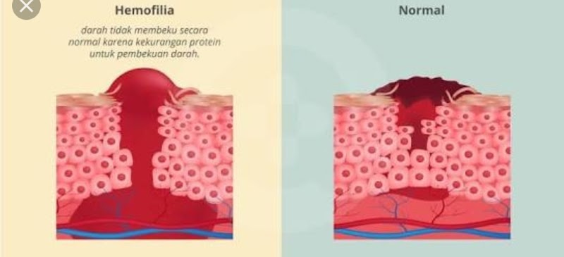 Paling Keren Gambar Kelainan Pada Manusia Hewan Dan Tumbuhan Akibat Mutasi