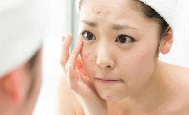 small-grainy-skin-and-improvement-measures-to-return-her-smooth-skin