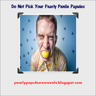 Do Not Pick Your Pearly Penile Papules