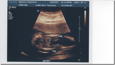 Bean's gender 001