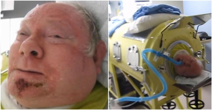 Heartbreaking Story Of Man Who Has Been Locked In A Machine For Over 60 Years