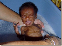 Sina 5 wks 1.7 kgs Mum died at birth.bmp