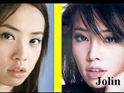 ดาราจีนไต้หวัน ก่อน หลัง ศัลยกรรม Chinese Taiwanese star plastic surgery before and after