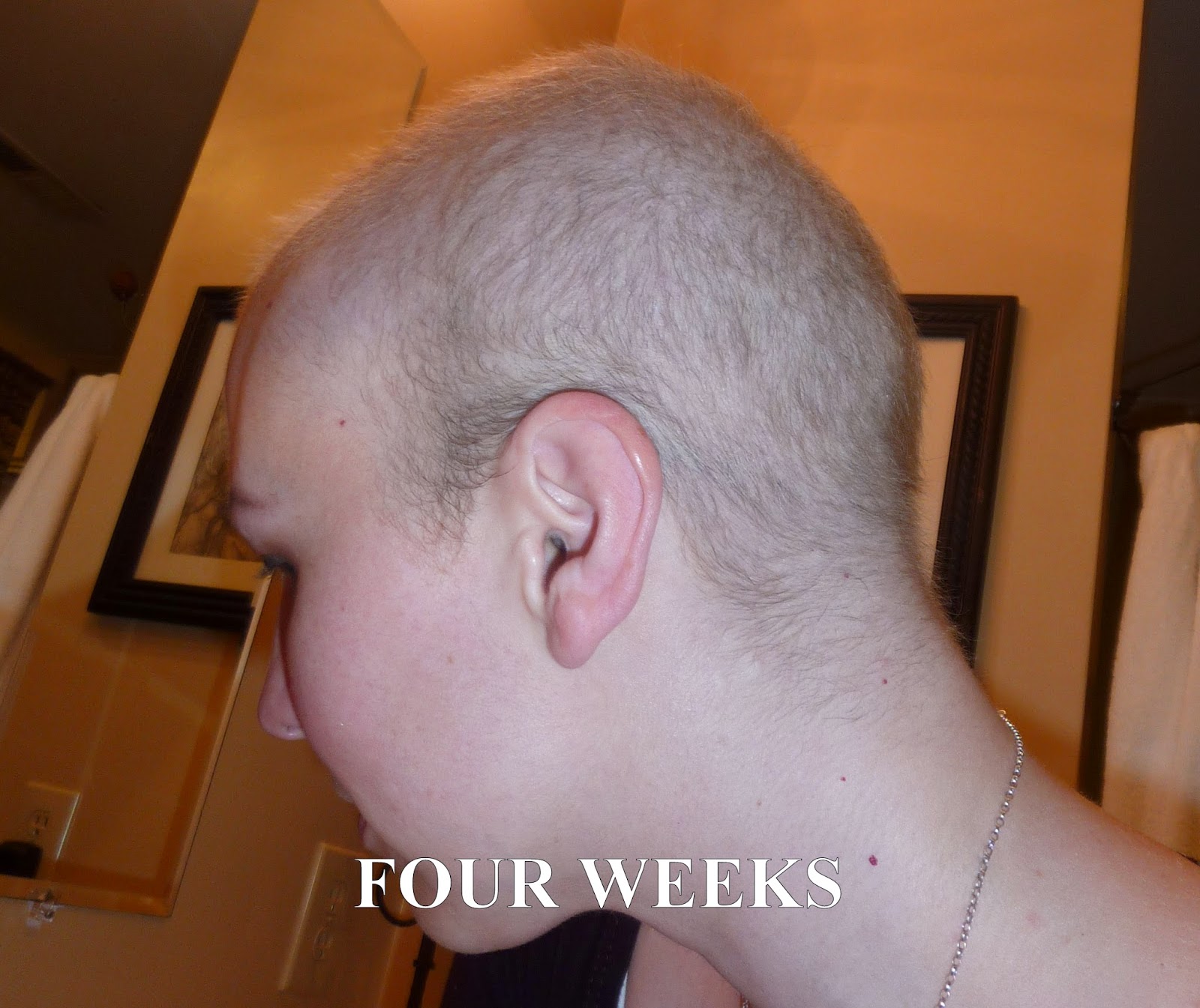 Anncredible Hair Growth Progression After Chemo Six Months With