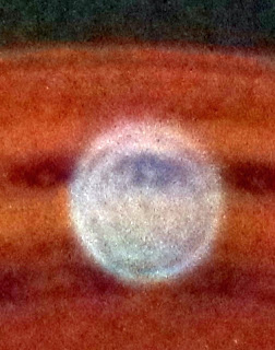 orb eye