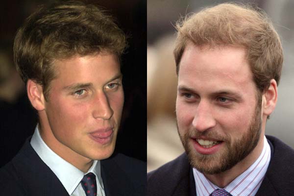 prince william bald. prince william baby photos