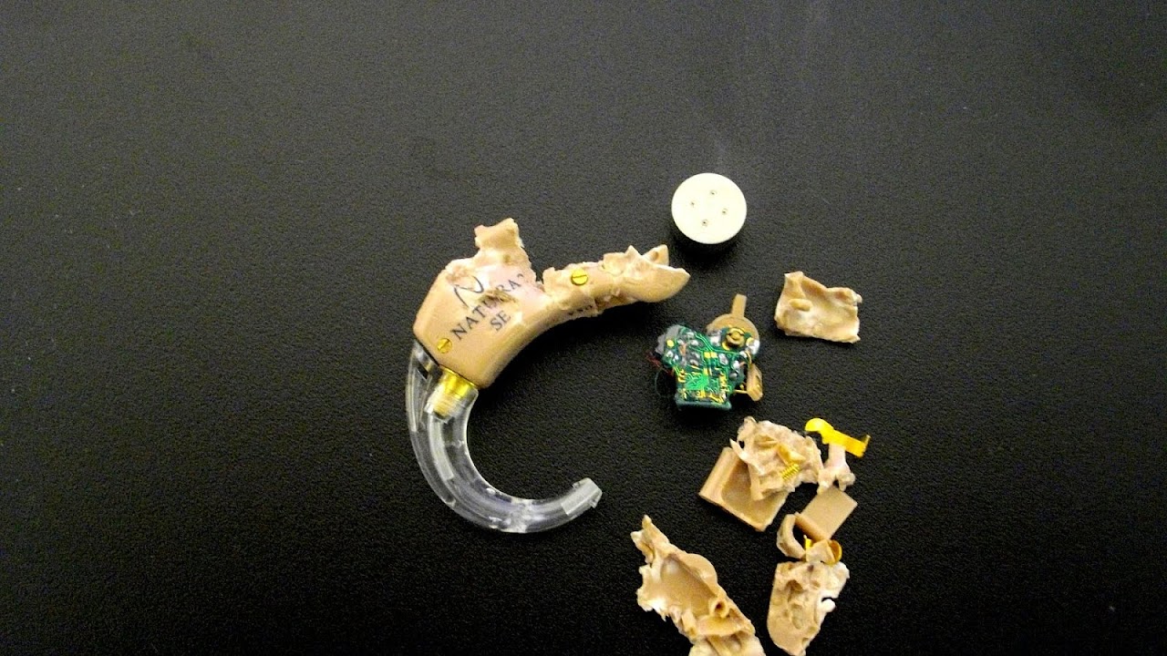 How Can Your Hearing Be Damaged