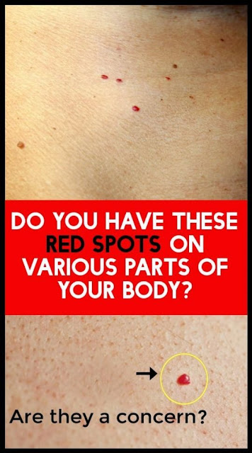 What Do These Red Dots on Your Skin Mean? What Do These Red Dots on Your Skin Mean?
