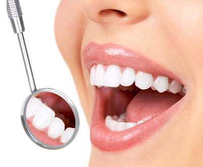 Quy trình bọc răng răng sứ cho răng hàm