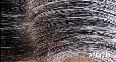 White Hair: Troubled with white hair .. but follow these 3 tips without coloring!
