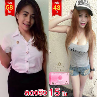   ลดน้ําหนัก 1 เดือน 30 กิโล, ลดน้ำหนัก 40 กิโล, ลดน้ําหนัก 1 เดือน 30 กิโล pantip, ลดน้ำหนัก 20 กิโล 1 เดือน, กินแตงโมลดน้ำหนัก, ลด-น้ำหนัก 20 กิโล 1 เดือน pantip, ลดความอ้วน 10 กิโล 2 อาทิตย์, ลด น้ำหนัก 20 กิโล 2 เดือน, วิธีลดน้ําหนัก 15 กิโลภายใน 1 เดือน