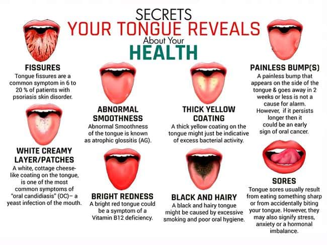 Oral Medicine Tongue