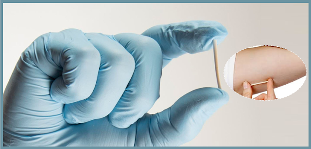 Implante Contraceptivo Inplanton: Uma Opção Confiável para o Controle de Natalidade
