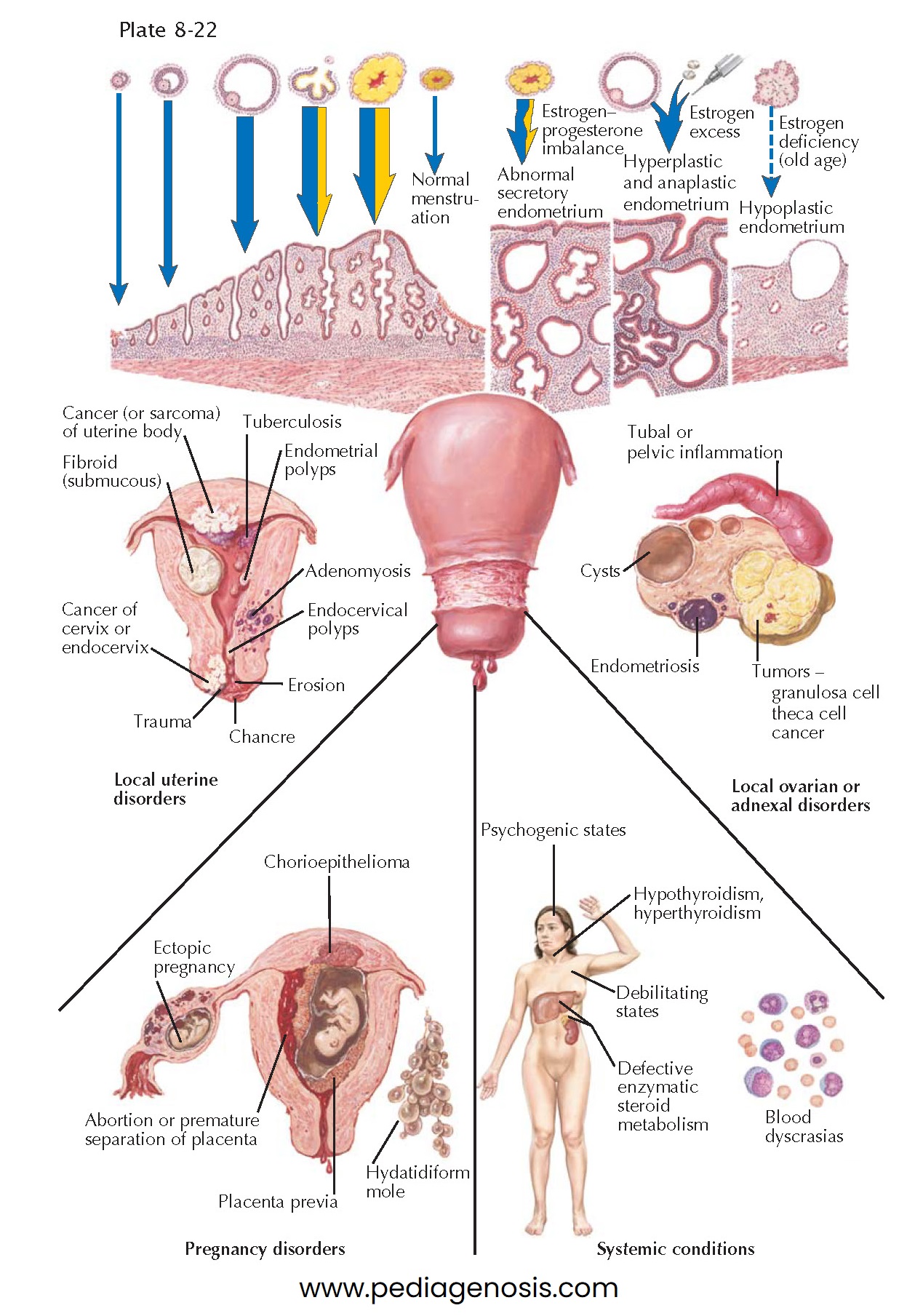 CAUSES OF UTERINE BLEEDING