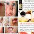 How To Cure Impetigo In 3 Days Or Less, Natural Remedies