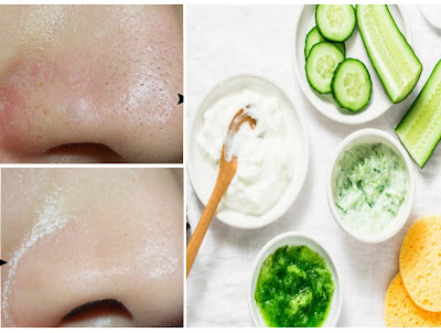 Préparer un masque naturel pour fermer les pores du visage rapidement
