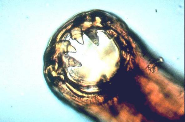 Selamat Datang ke Blog Dr. Azwan: Cutaneous Larva Migrans