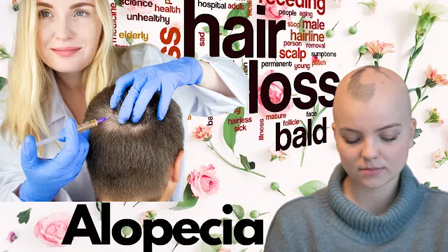 Alopecia Causes and Treatments
