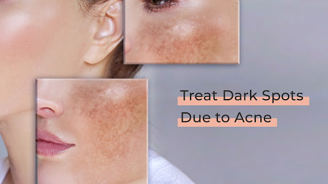 Reduce dark spots on face