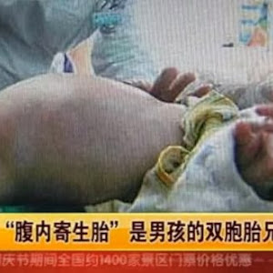Heboh, Bayi Laki-laki Berumur 2 Tahun di China Hamil