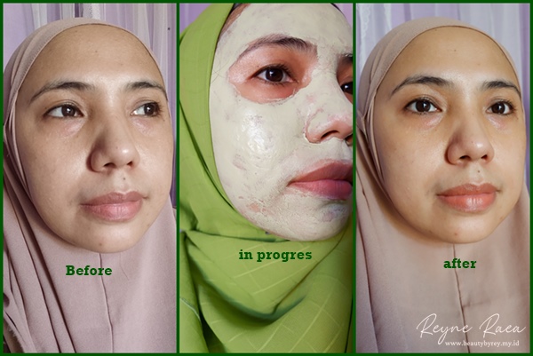 Review SKINTIFIC Mugwort Anti Pores & Acne Clay Mask