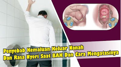 Obat untuk kelamin kencing sakit dan keluar nanah sembuh sendiri