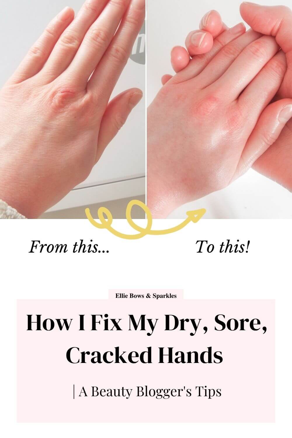 Pinterest pin, showing difference in my dry, sore, cracked hands to my healed, nourished hands, with arrows and text reading "from this..." "to this!". A pink title card sits below, reading "How I Fix My Dry, Sore, Cracked Hands" in bold text and "| A Beauty Blogger's Tips" in a smaller subheading.