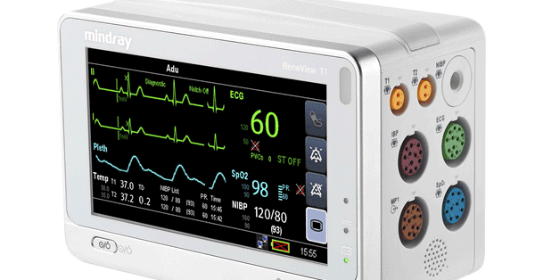 Pasien Monitor Portable Multifungsi Patient Monitor 
