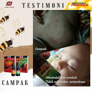 manfaat british propolis untuk anak