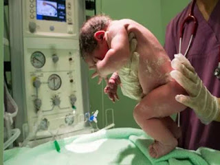 أسعار الولادة في مستشفيات السعودية - ولادة طبيعية و قصرية 1445