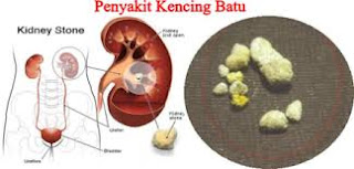 obat alami penyembuh ginjal