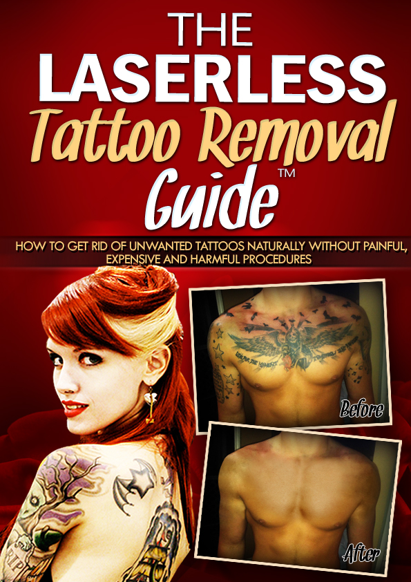 The Lasserless Tattoo Removal Guide