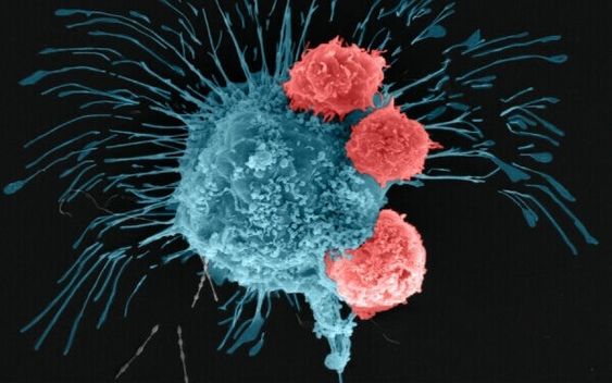 9 Differences Between Tumors and Cancer, How to Treat Them ?