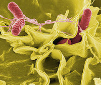 bakteri salmonela tifoid