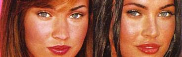 megan fox plastic surgery