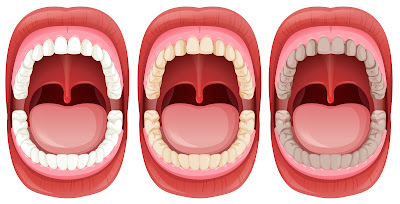 three teeth structure
