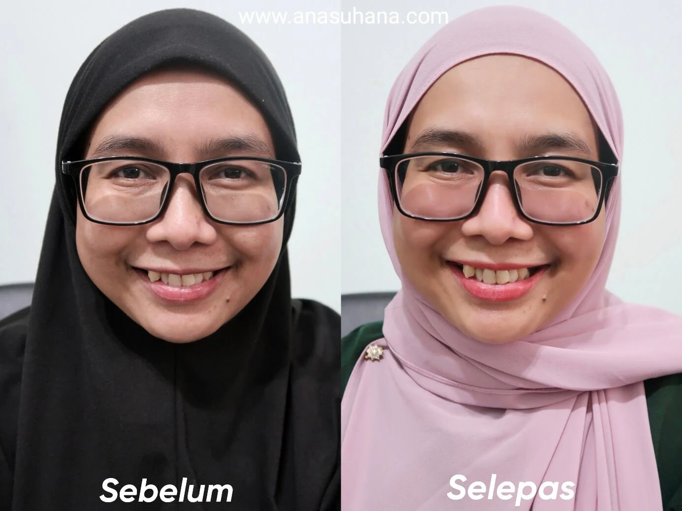 Syahirah Korean Secret White Glow Brightening Plus Essence